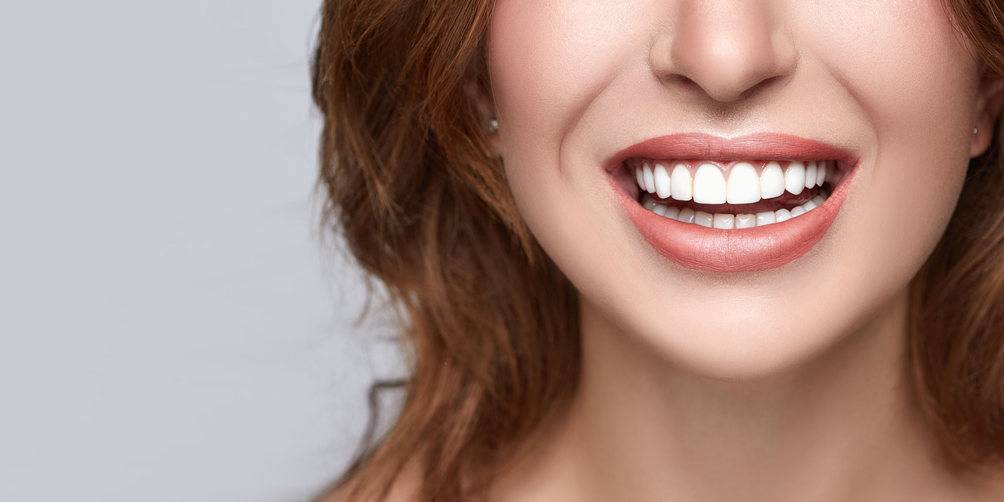 smile-makeover-patient-2 smile makeover patient