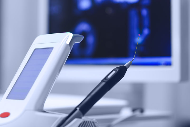dental laser equipment