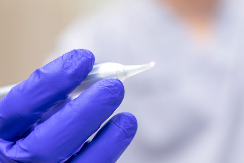 Dental Periodontal Laser