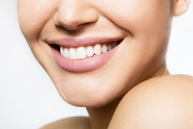 Smile Makeover Patient