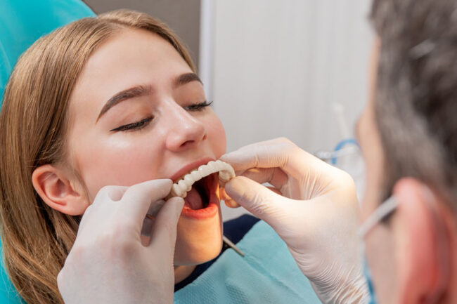 a-dental-patient-being-prepped-for-a-full-arch-implant a dental patient being fitted for full mouth dental implant restorations.