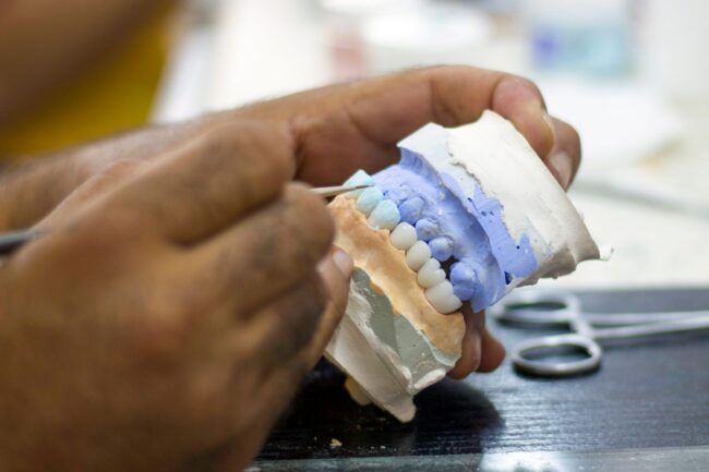 Full,Tooth,And,Whole,Dental,Prosthesis,Construction a dentist painting a full mouth all on x dental prosthetic implant model.