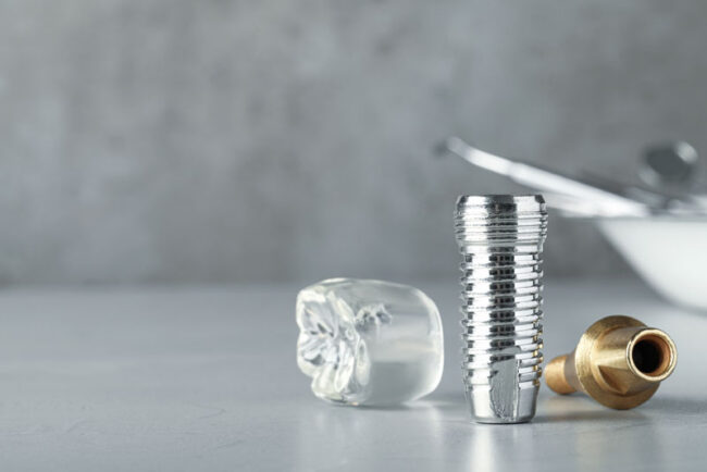 dental-implant-post-model a titanium dental implant post and crown model.