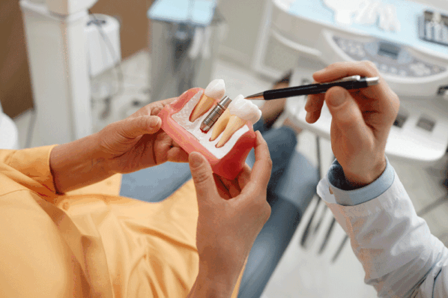 dentalimplants1-12-23 Woman holding tooth model during consultation on dental implant