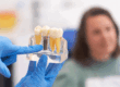 Close-up of dental model with implant. patient of dental clinic on blurred background. dentistry