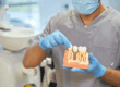 A dental doctor with a model of a dental implant in his hands