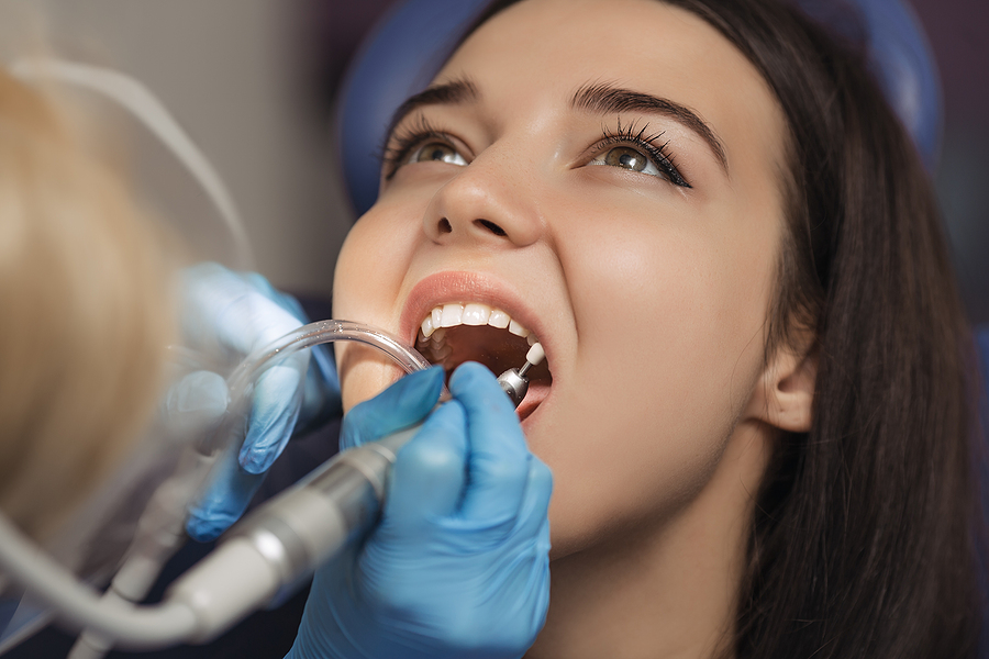 Professional Dental Cleaning