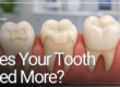 teeth