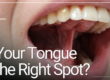 open mouth showing a tongue-tie